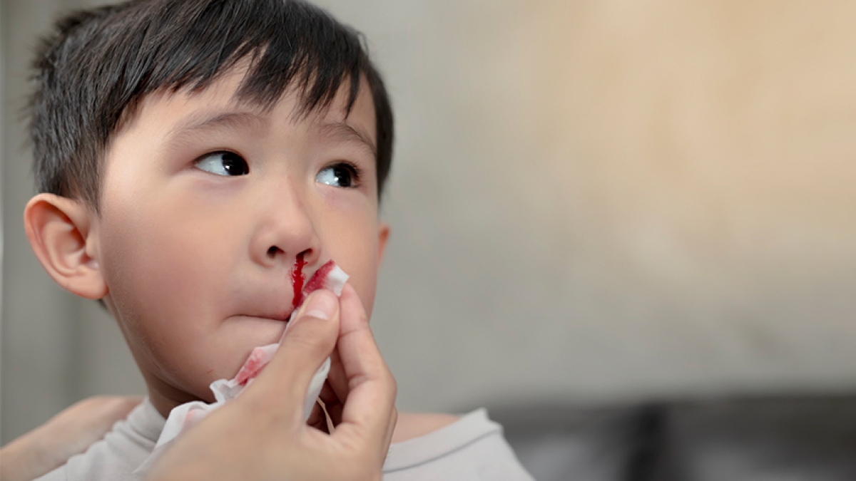 Chảy máu cam và những điều cần biết ở trẻ nhỏ
