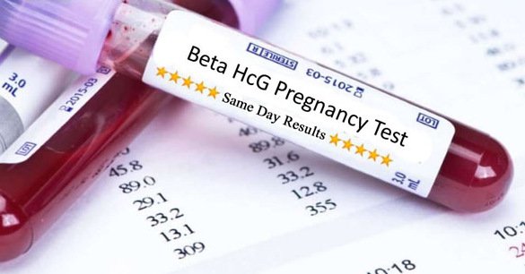 Xác định có thai bằng phương pháp xét nghiệm máu có tính chính xác cao?