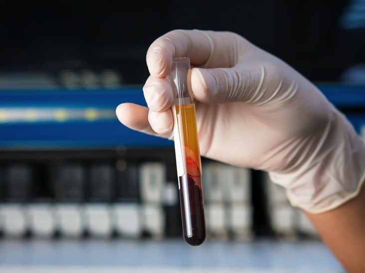Xét nghiệm đông máu: Activated partial thromboplastin (APTT)