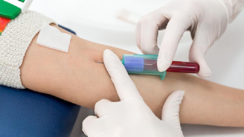Xét nghiệm Folate được sử dụng như thế nào trong chẩn đoán lâm sàng?