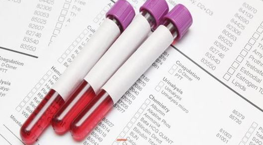Xét nghiệm kháng đông lupus (LA)